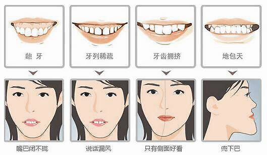 在廊坊矫正牙齿有最佳年龄？什么时候做最好？