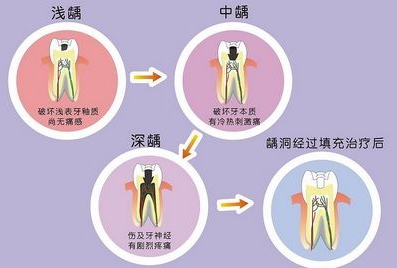 在廊坊，口腔检查都检查什么？