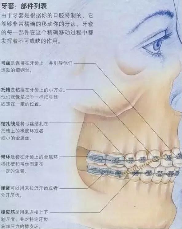 牙齿矫正原理，一根弓丝的力量有多强大？！