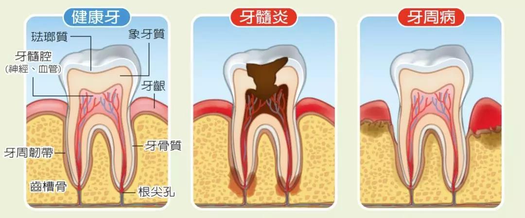 还在喊牙疼？这 7 种原因都需要及时治疗！