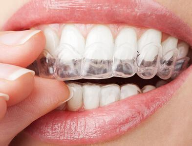 【正畸人士必看】3种牙齿矫正器的区别是什么？