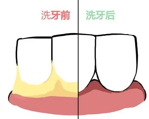 护齿误区大盘点，快来围观一下！