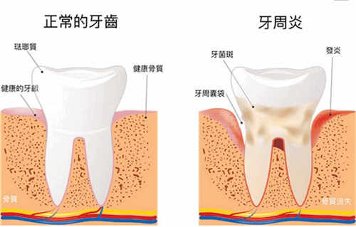 口腔“小”问题，竟然与肾脏“大”问题有关系？