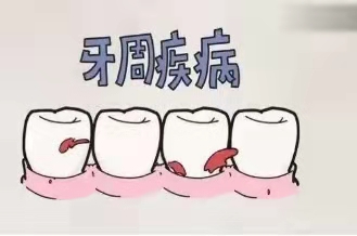 「重点」种植牙手术前，牙周疾病不能有！