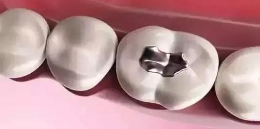 要像爱护钻石一样保护自己的牙齿！