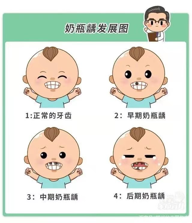 4岁娃15颗烂牙需全麻治疗，害人不浅的奶瓶龋，再不注意就晚了！