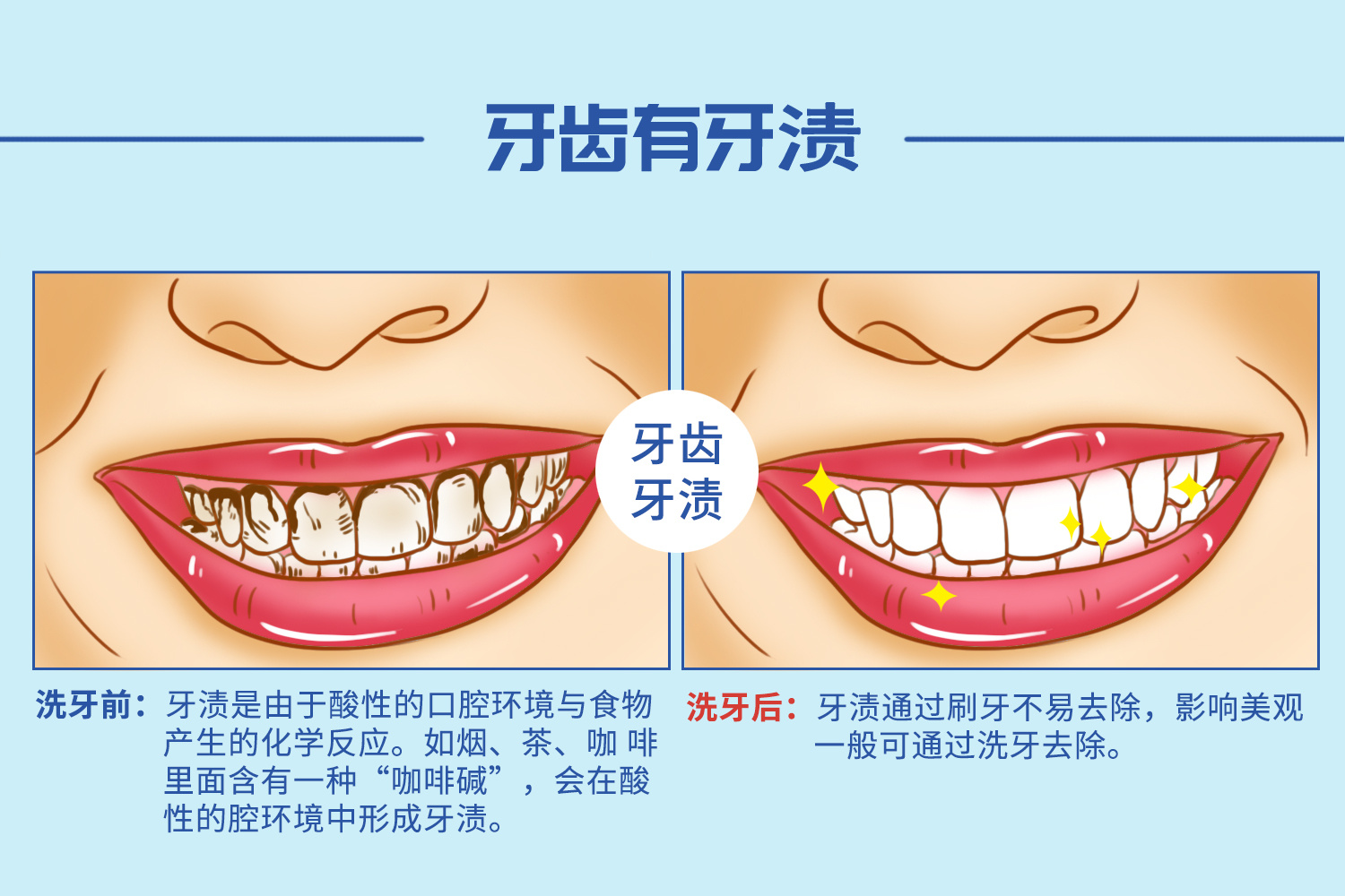 摄图网_401864551_洗牙口腔医学插图(非企业商用).jpg