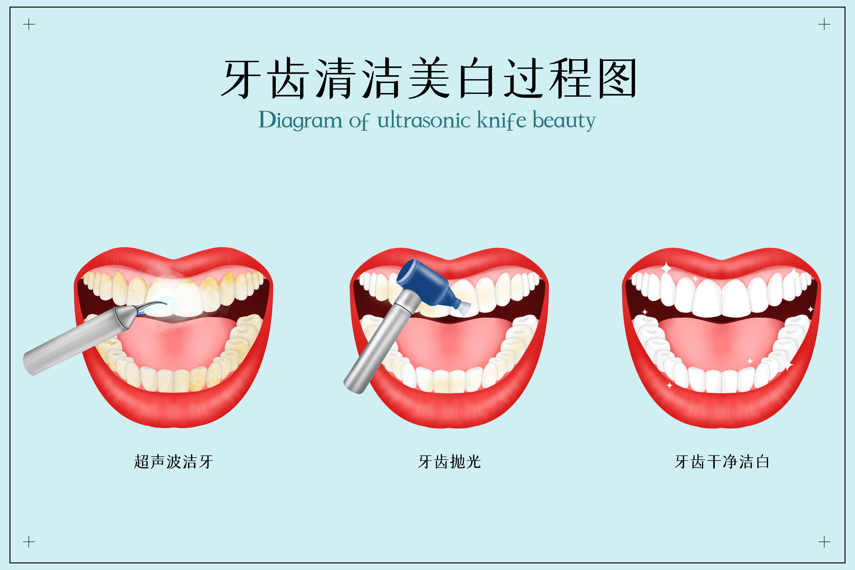 摄图网_401868465_牙齿清洁美白医疗配图(非企业商用).jpg